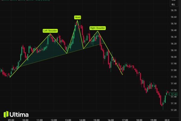 cấu trúc mô hình vai đầu vai