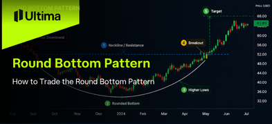 How to Trade the Round Bottom Pattern